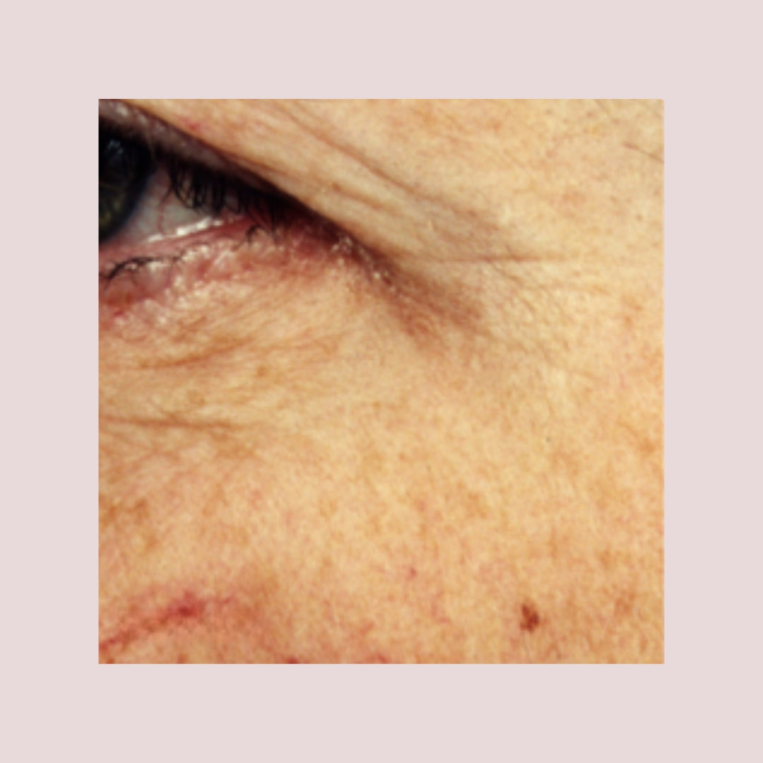 A closeup image of a middle aged woman's cheek and eye, highlighting wrinkles in the eye area.
